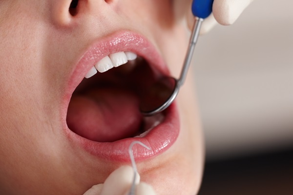 What To Expect At A Professional Dental Cleaning