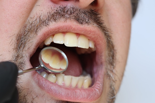 Things A Dental Cleaning Can Prevent
