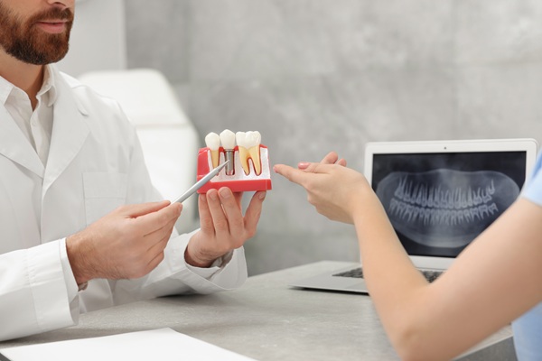 Dental Crowns And Front Teeth: What You Should Know